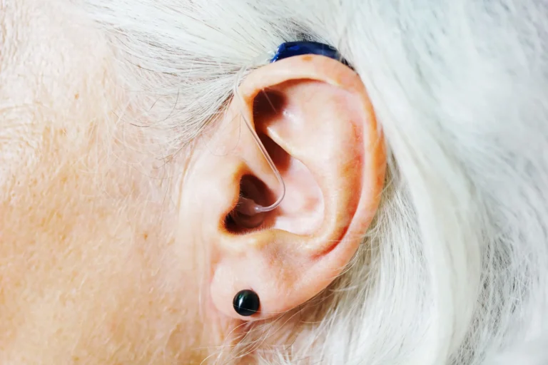 A Comprehensive Guide to the World of Hearing Aids